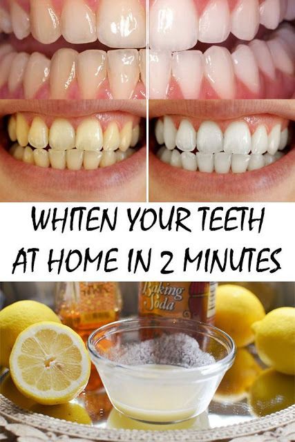 whiten-your-teeth-at-home-in-just-2.jpg